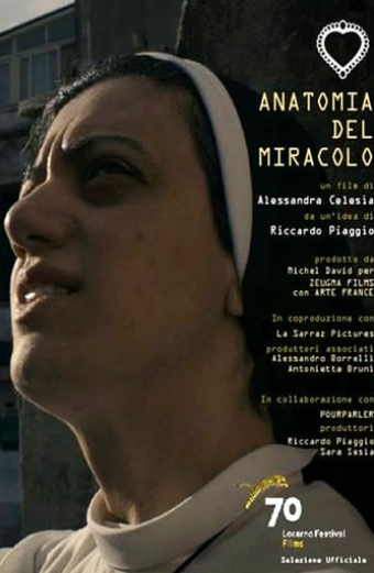 Anatomia del miracolo