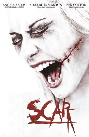 Scar